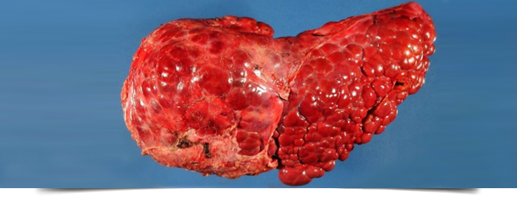 Best Gastroenterologist in Bathinda