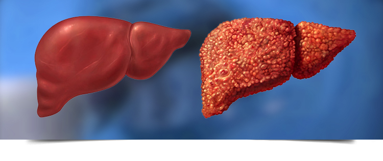 Best Gastroenterologist in Bathinda