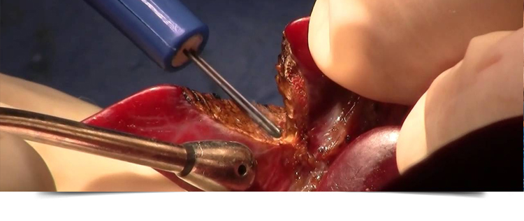 Best Gastroenterologist in Bathinda