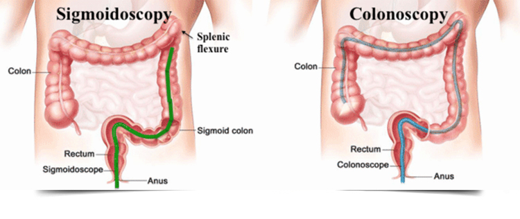 Best Gastroenterologist in Bathinda