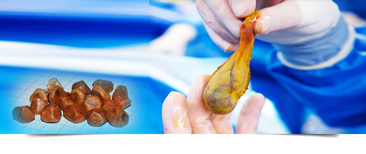 Best Gastroenterologist in Bathinda