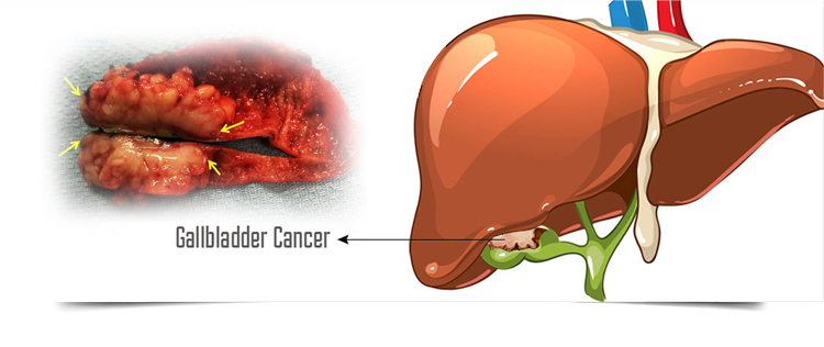 Best Gastroenterologist in Bathinda