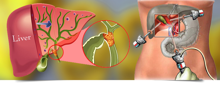 Best Gastroenterologist in Bathinda