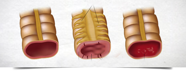 Best Gastroenterologist in Bathinda