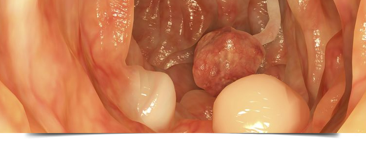 Best Gastroenterologist in Bathinda