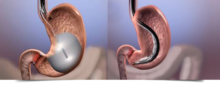 Best Gastroenterologist in Bathinda