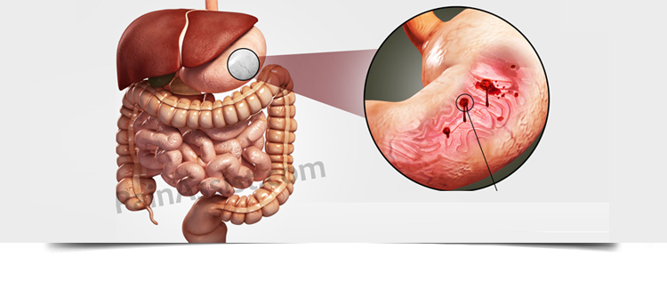 Best Gastroenterologist in Bathinda